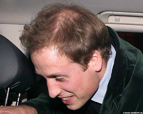prince william getting bald young. The prince#39;s personal struggle